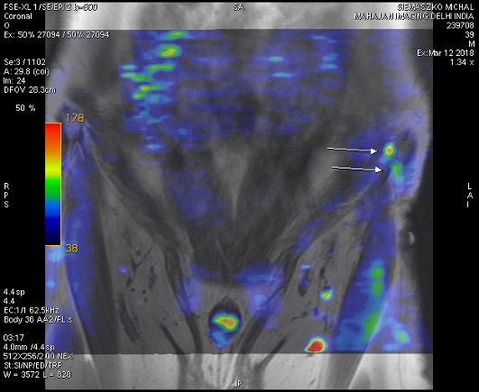 MRI of nervous system - selected frames from DICOM data