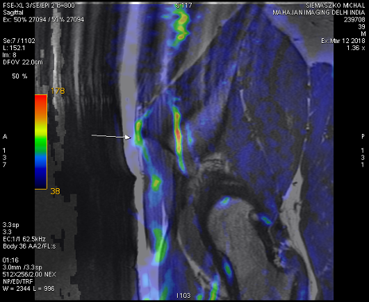 MRI of nervous system - selected frames from DICOM data